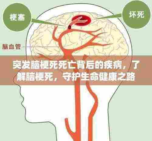 突发脑梗死死亡背后的疾病，了解脑梗死，守护生命健康之路