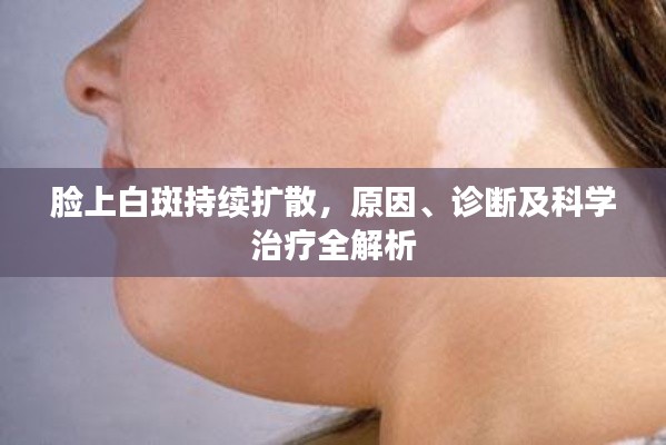 脸上白斑持续扩散,原因、诊断及科学治疗全解析